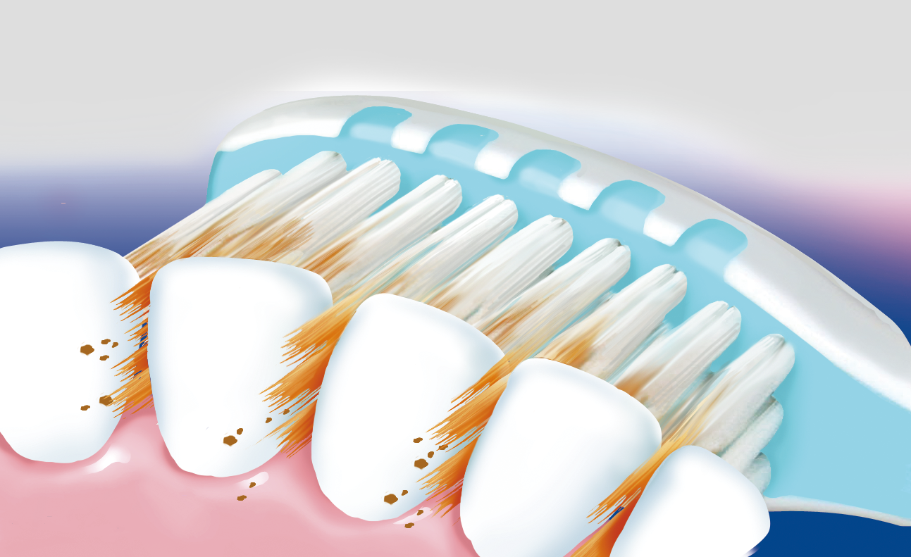 BROSSE À DENTS EXTRA CLEAN-SOIES MOYENNES